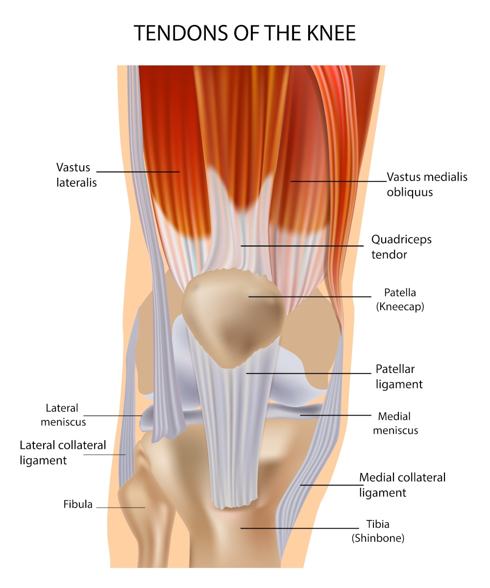 lussazione rotula cure